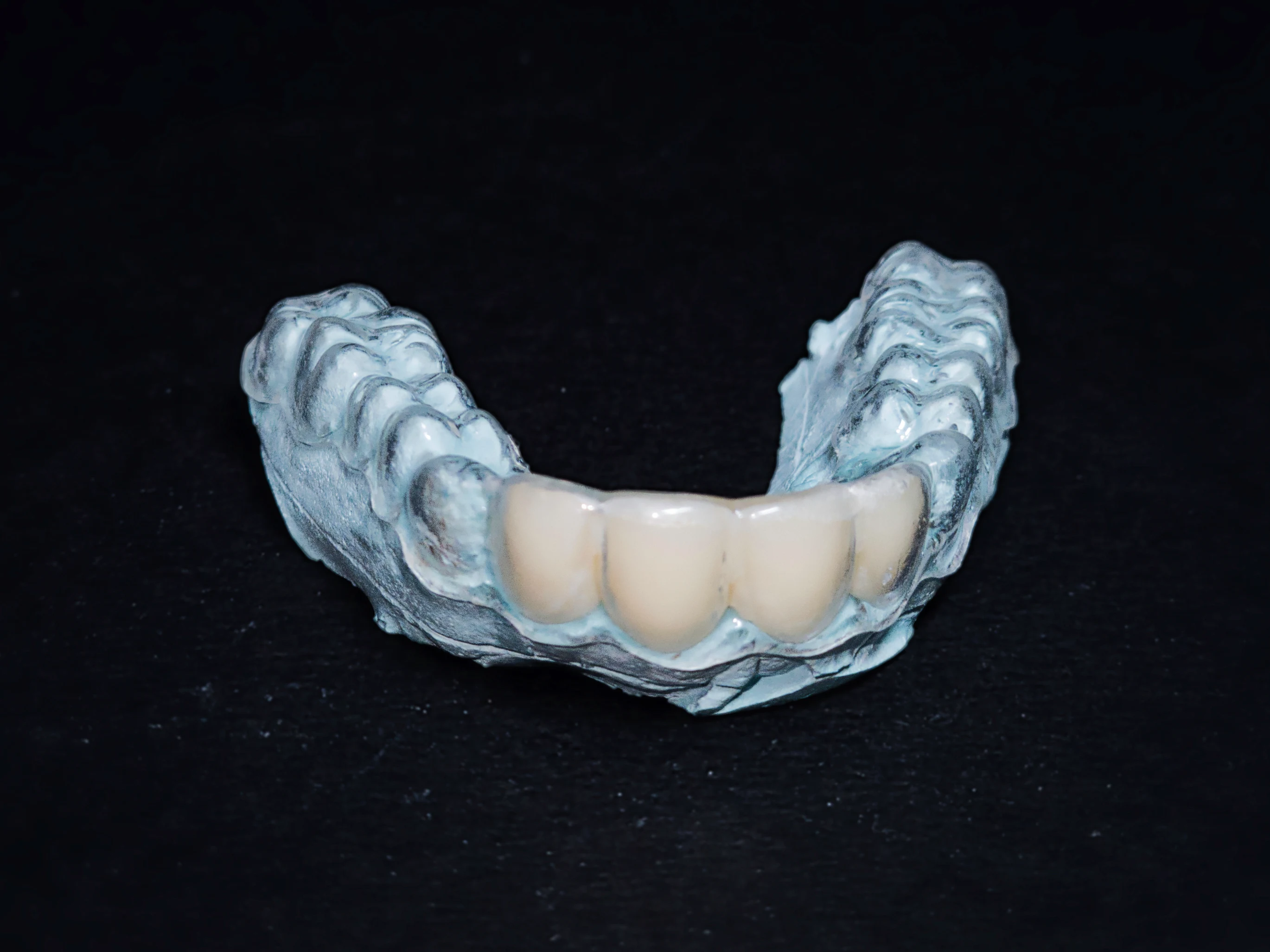 Retainers