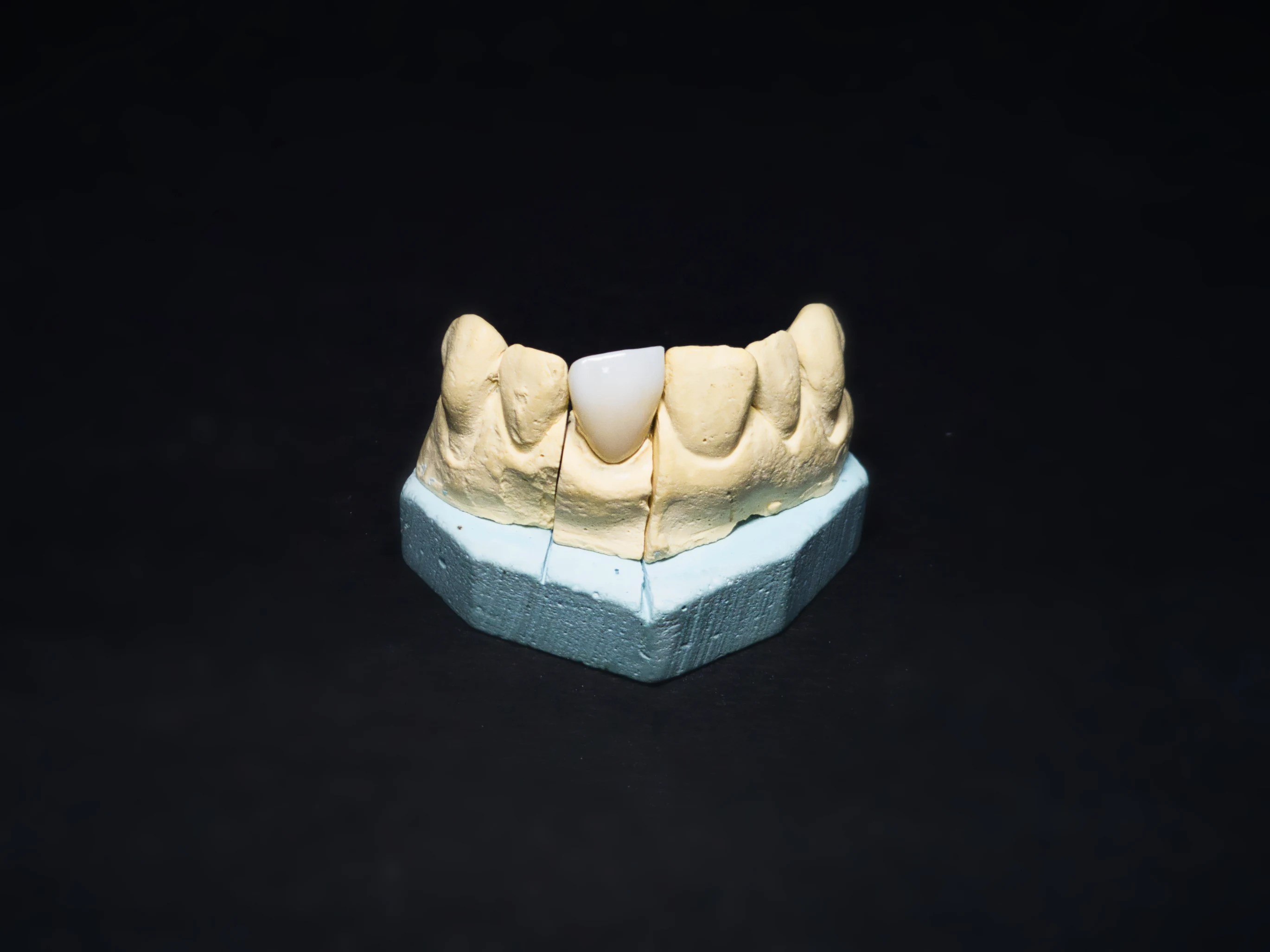 Zirconia Crowns