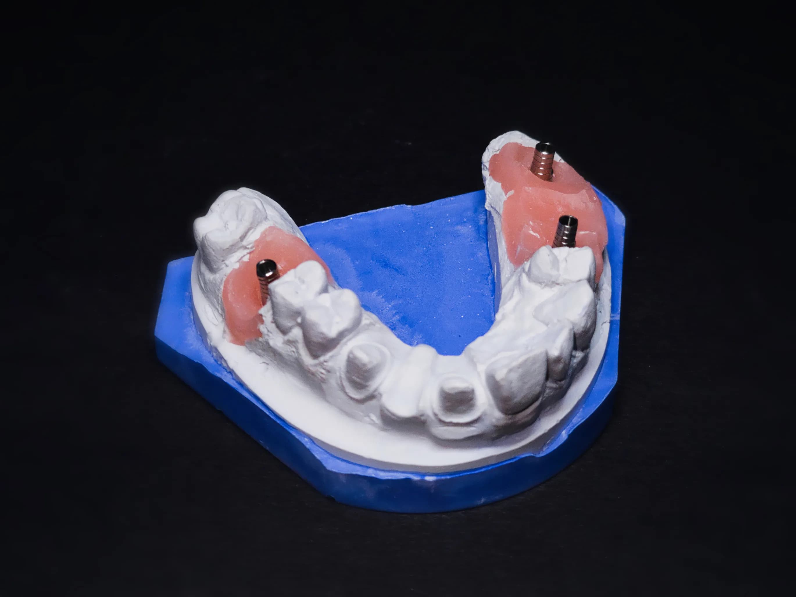 Full arch implant framework on model by ARR Dental Lab