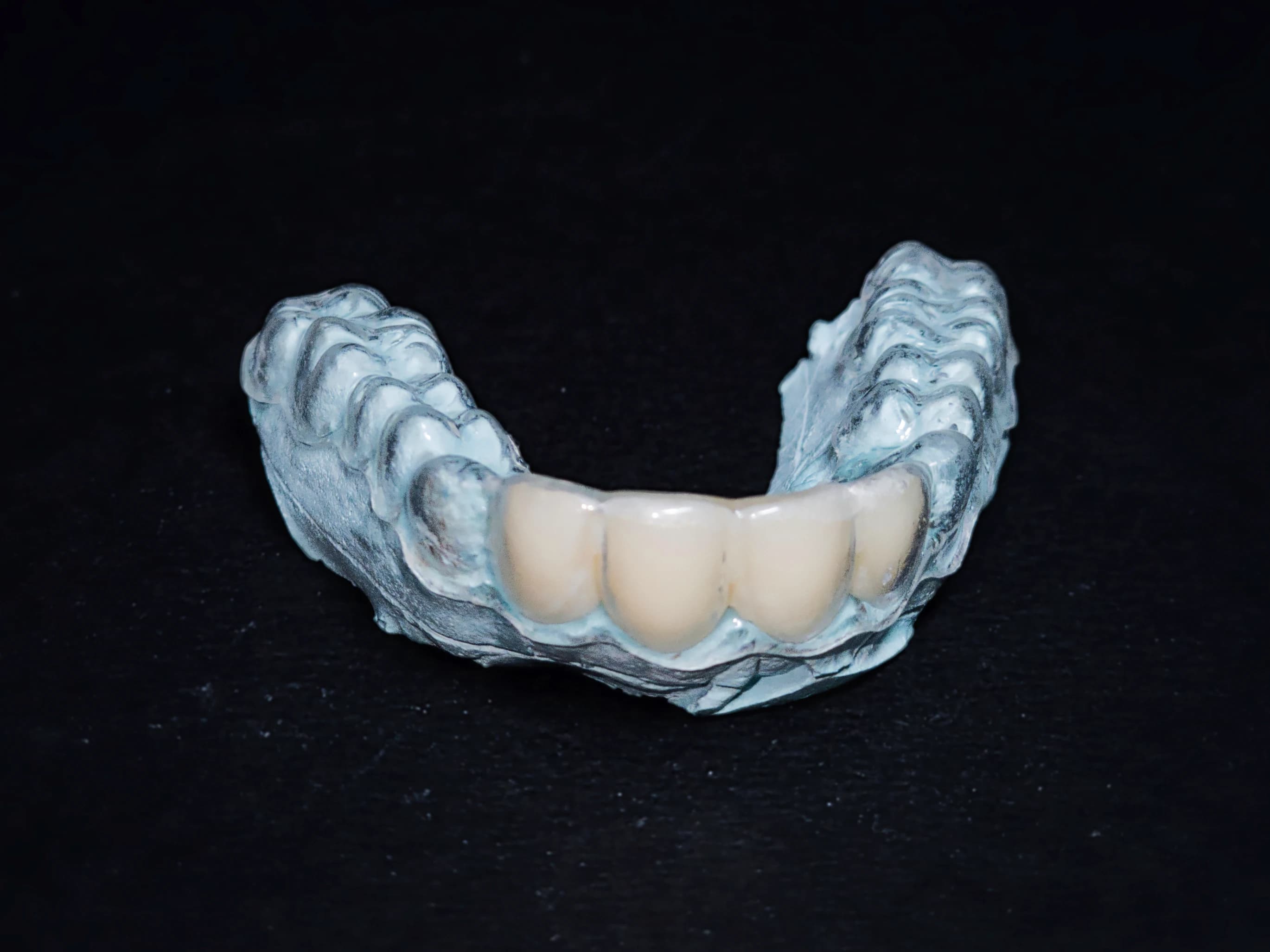 Clear retainer by ARR Dental Lab